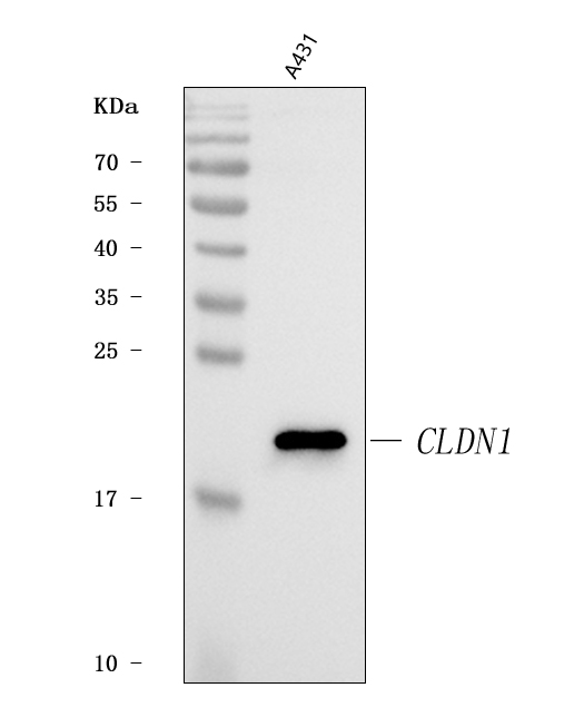  Western blot analysis of Claudin 1/CLDN1 using anti-Claudin 1/CLDN1 antibody (A01585-3)