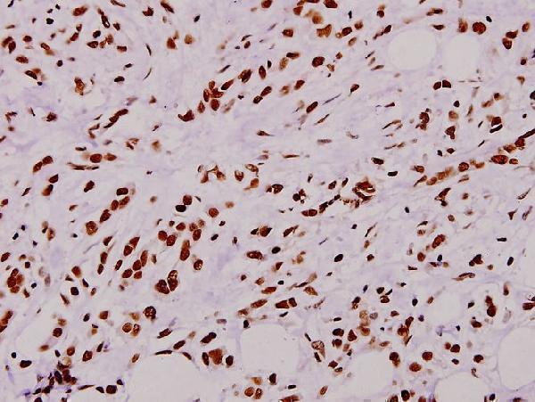 a01586 2 ncf1 primary antiboties ihc testing 2