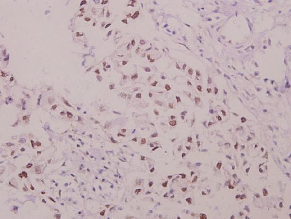 a01586s304 ncf1 primary antiboties ihc testing 2