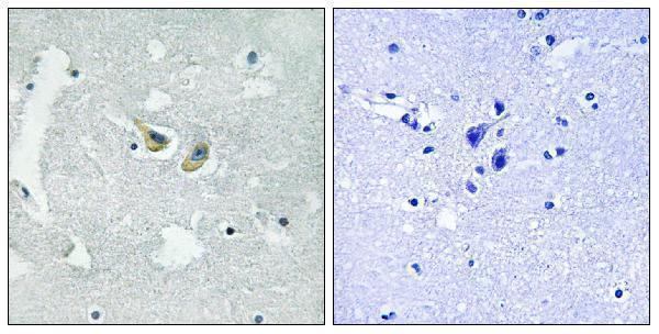 a01586s345 ncf1 primary antibodies ihc testing 1