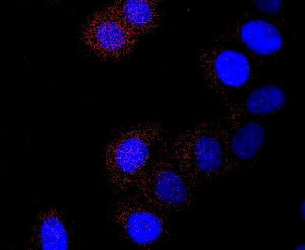 ICC staining Cathepsin L/V/K/H in HepG2 cells (red)