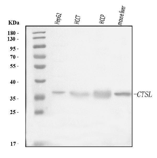  Western blot analysis of Cathepsin L/MEP/CTSL using anti-Cathepsin L/MEP/CTSL antibody (A01589-2)