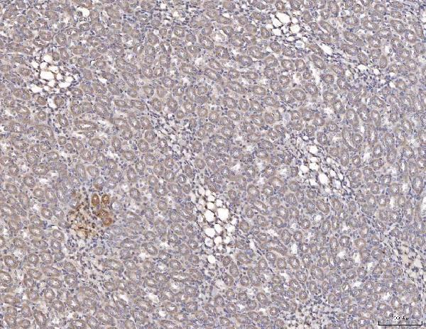  IHC analysis of Cathepsin L/MEP/Ctsl using anti-Cathepsin L/MEP/Ctsl antibody (A01589-3)