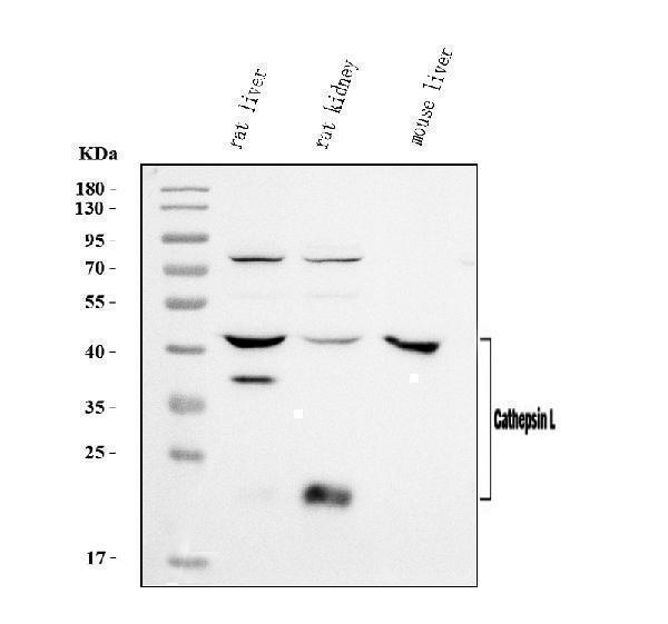  Western blot analysis of Cathepsin L/MEP/Ctsl using anti-Cathepsin L/MEP/Ctsl antibody (A01589-3)