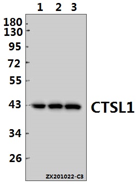 Western blot (WB) analysis of CTSL1 pAb at 1:500 dilution
Lane1:U-87MG whole cell lysate(40ug)
Lane2:A549 whole cell lysate(40ug)
Lane3:HepG2 whole cell lysate(40ug)