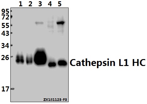 Western blot (WB) analysis of Cathepsin L1 HC (T288) polyclonal antibody at 1:500 dilution
Lane1:A549 whole cell lysate(40ug)
Lane2:L02 whole cell lysate(10ug)
Lane3:Beas-2B whole cell lysate(40ug)
Lane4:AML-12 whole cell lysate(40ug)
Lane5:PC12 whole cell lysate(40ug)