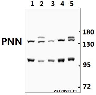 Western blot (WB) analysis of PNN polyclonal antibody at 1:500 dilution
Lane1:C6 whole cell lysate(40ug)
Lane2:PC12 whole cell lysate(40ug)
Lane3:CT26 whole cell lysate(40ug)
Lane4:HCT116 whole cell lysate(40ug)
Lane5:HepG2 whole cell lysate(40ug)
