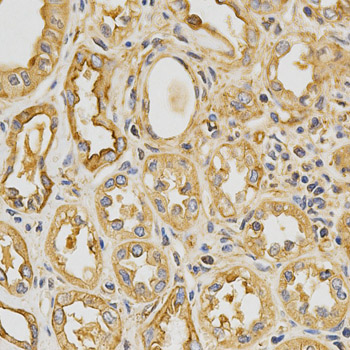 Immunofluorescence analysis of HeLa cells using Tropomyosin 1 antibody 