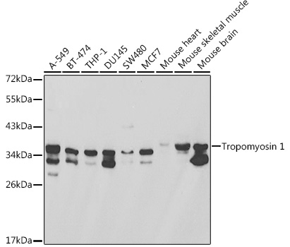 Western blot analysis of extracts of various cell lines, using Tropomyosin 1 antibody  at 1:1000 dilution