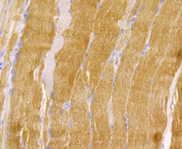 a01591 2 tpm1 primary antiboties ihc testing 2