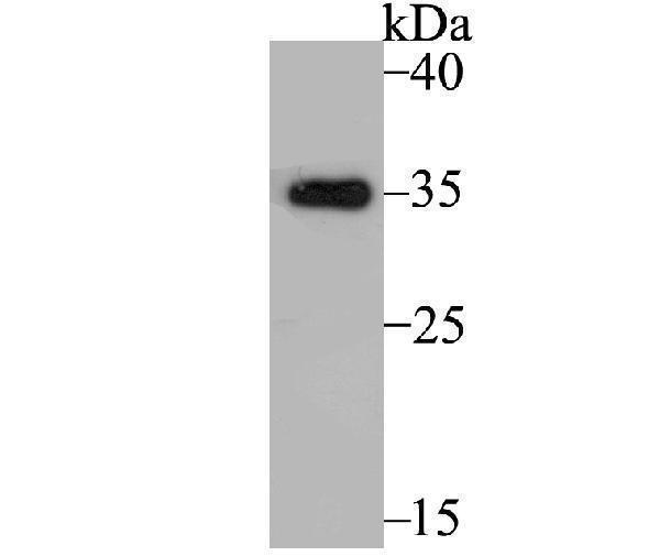a01591 2 tpm1 primary antiboties wb testing 1