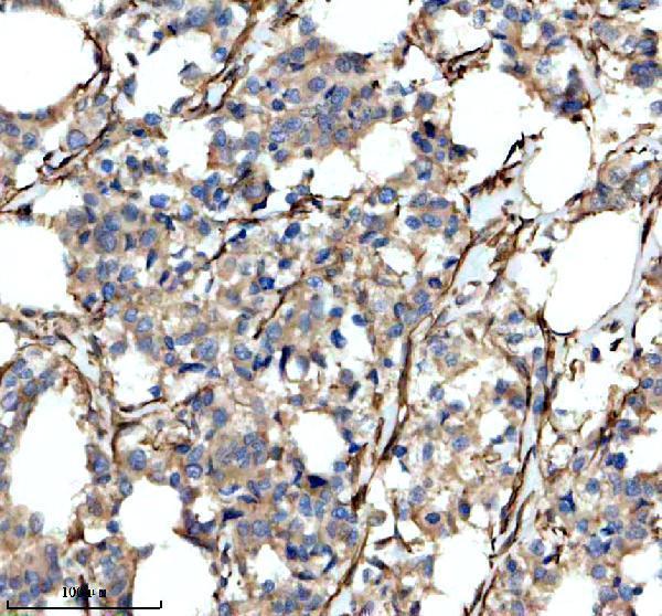 a01591 4 tpm1 2 3 4 primary antibodies ihc testing 1