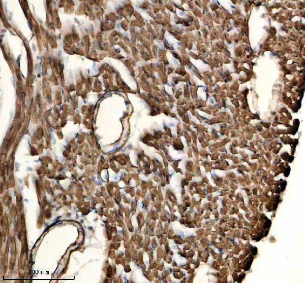 a01591 4 tpm1 2 3 4 primary antibodies ihc testing 2