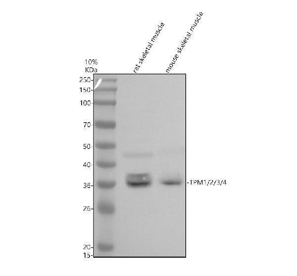 Anti-TPM1/2/3/4 Antibody Picoband&reg;