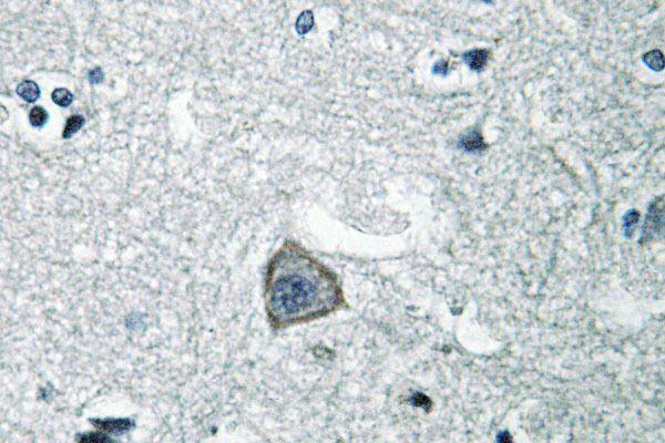 a01593 htr2c primary antiboties ihc testing 2