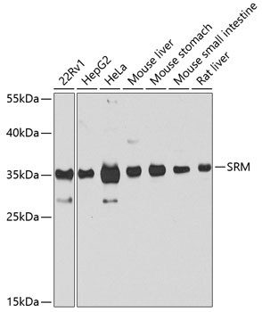 a01594 srm primary antiboties wb testing 1