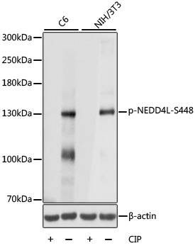 Western blot analysis of extracts of various cell lines, using Phospho-NEDD4L-S448 antibody