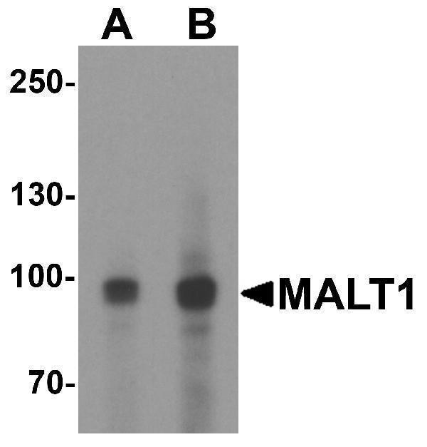 Western blot analysis of MALT1 in EL4 cell lysate with MALT1 antibody at (A) 1 and (2) μg/ml