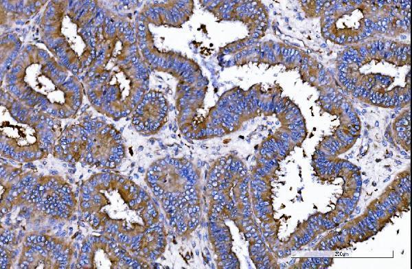a01603 1 iqgap1 primary antibodies ihc testing 2