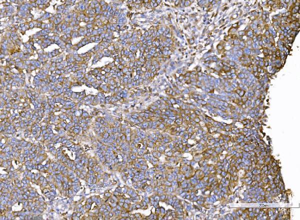 a01603 1 iqgap1 primary antibodies ihc testing 3