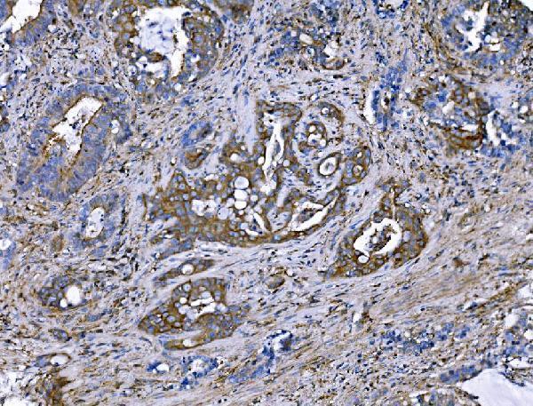 a01603 1 iqgap1 primary antibodies ihc testing 4