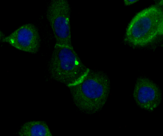 a01603 2 iqgap1 primary antiboties icc testing 2