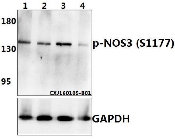 a01604s1177 nos3 primary antiboties wb testing 2