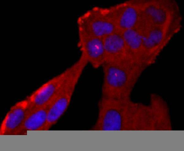 a01607 1 elane primary antiboties icc testing 2