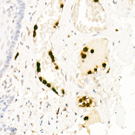 a01607 elane primary antiboties ihc testing 3
