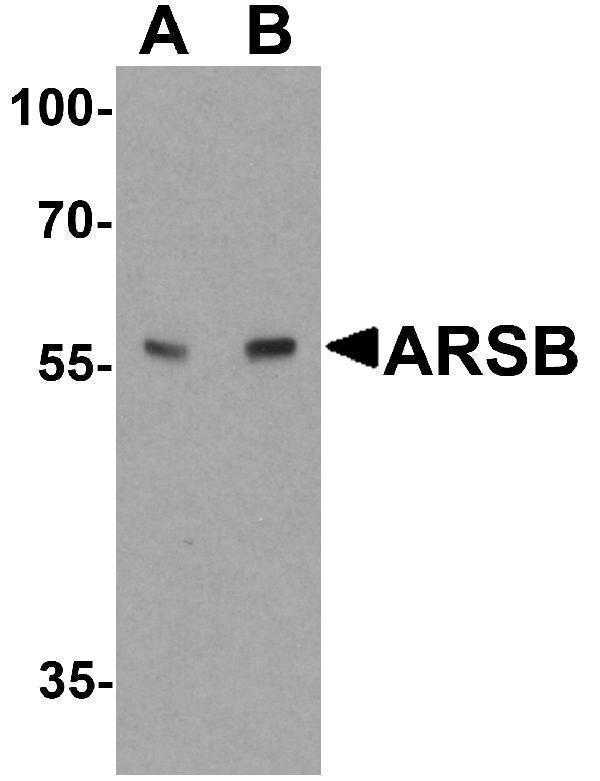 a01609 arsb primary antibodies wb testing 1