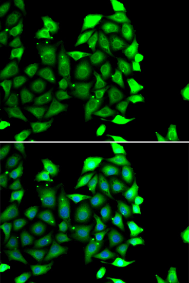 Immunofluorescence analysis of MCF-7 cells using IKZF3 antibody 