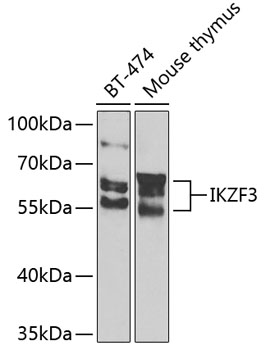 Western blot analysis of extracts of various cell lines, using IKZF3 Antibody  at 1:1000 dilution