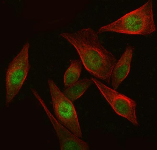 a01611 2 ikzf3 primary antibodies if testing 5
