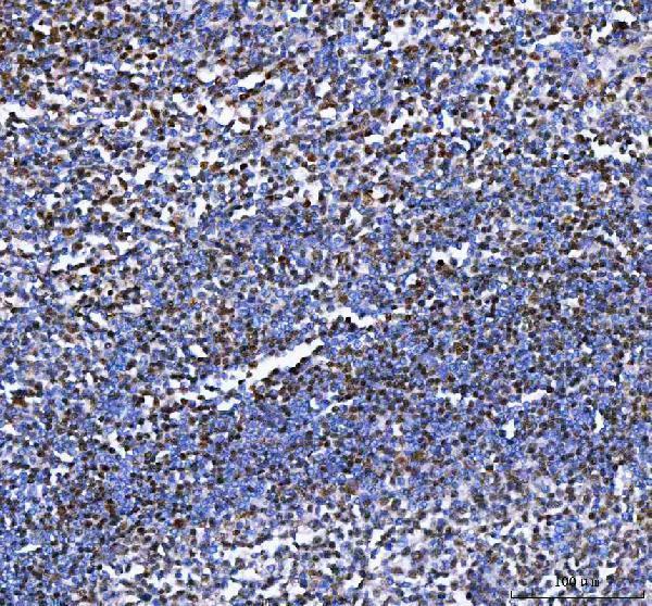  IHC analysis of IKZF3 using anti-IKZF3 antibody (A01611-2)
