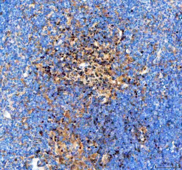  IHC analysis of IKZF3 using anti-IKZF3 antibody (A01611-2)
