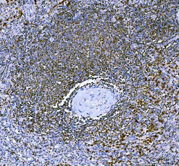a01611 2 ikzf3 primary antibodies ihc testing 4