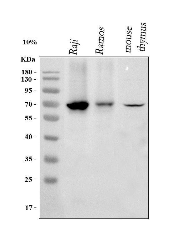  Western blot analysis of IKZF3 using anti-IKZF3 antibody (A01611-2)