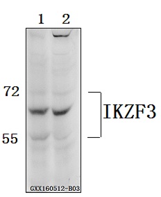 Western blot (WB) analysis of IKZF3 polyclonal antibody at 1:500 dilution
Lane1:Jurkat whole cell lysate(40ug)
Lane2:SGC7901 whole cell lysate(40ug)