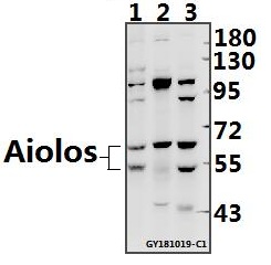 Western blot (WB) analysis of Aiolos (S386) polyclonal antibody at 1:500 dilution
Lane1:BV2 whole cell lysate(40ug)
Lane2:C6 whole cell lysate(40ug)
Lane3:K562 whole cell lysate(40ug)