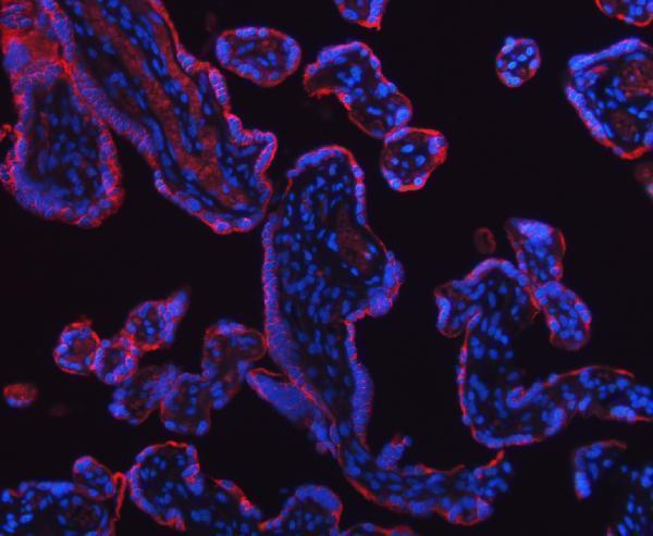 a01613 hsd11b2 primary antibodies if testing 8
