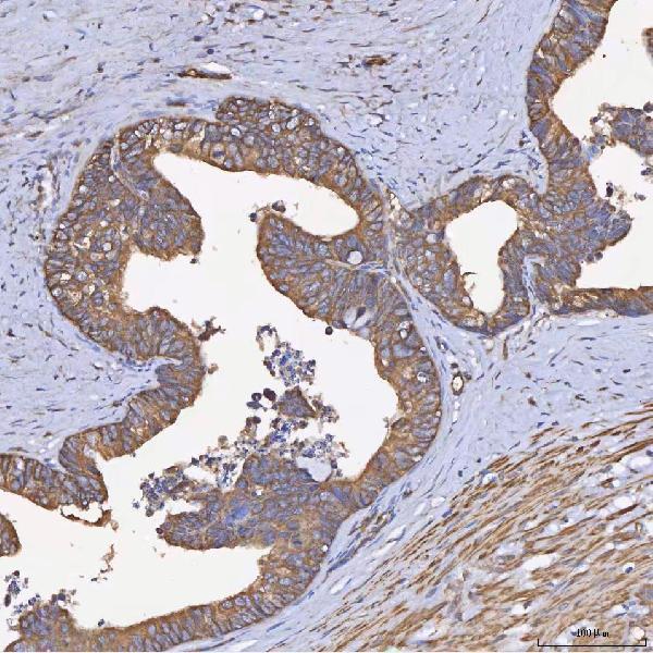 a01613 hsd11b2 primary antibodies ihc testing 4
