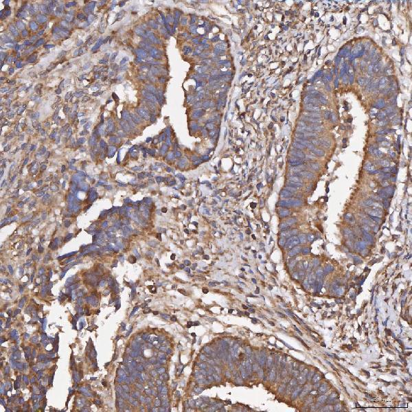 a01613 hsd11b2 primary antibodies ihc testing 5