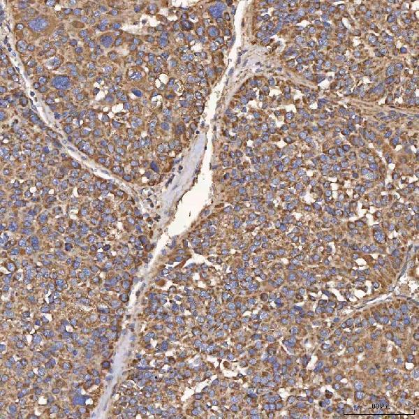 a01613 hsd11b2 primary antibodies ihc testing 6