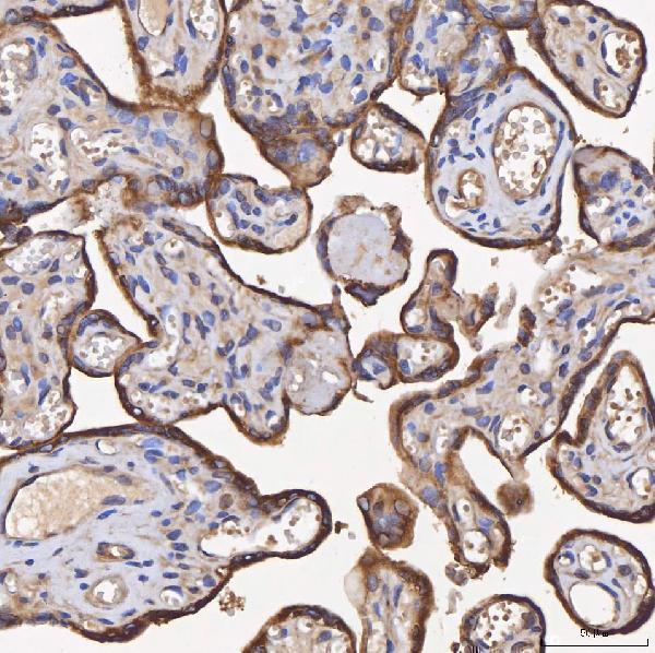a01613 hsd11b2 primary antibodies ihc testing 7