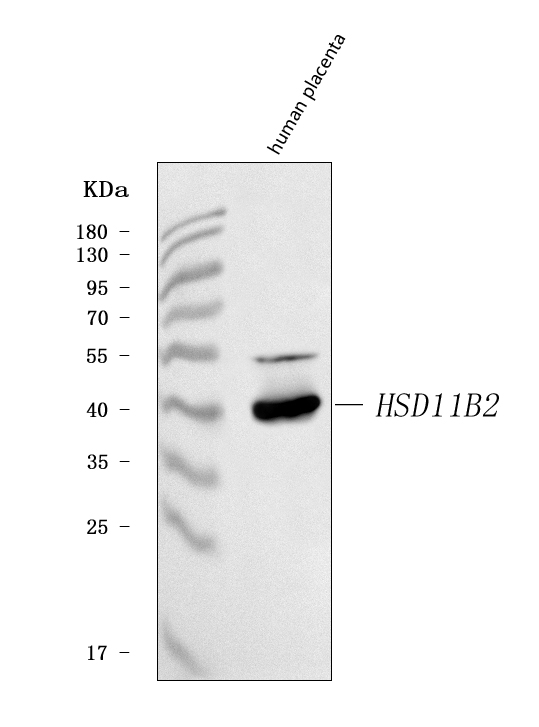  Western blot analysis of HSD11B2 using anti-HSD11B2 antibody (A01613)