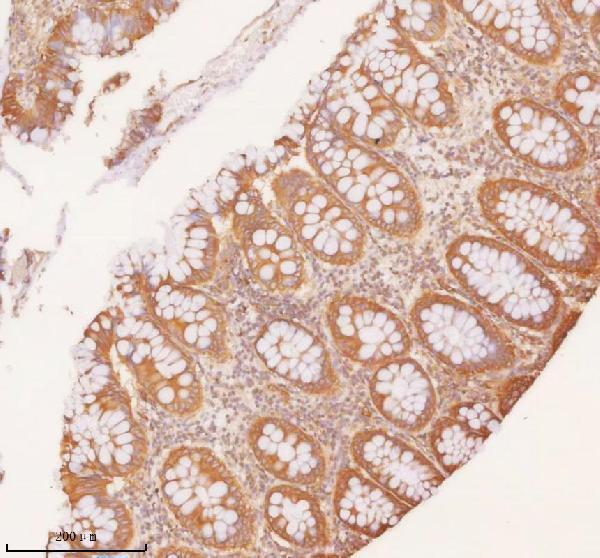  IHC analysis of SLK using anti-SLK antibody (A01614-2)