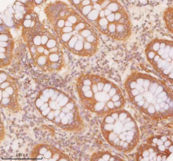  IHC analysis of SLK using anti-SLK antibody (A01614-2)