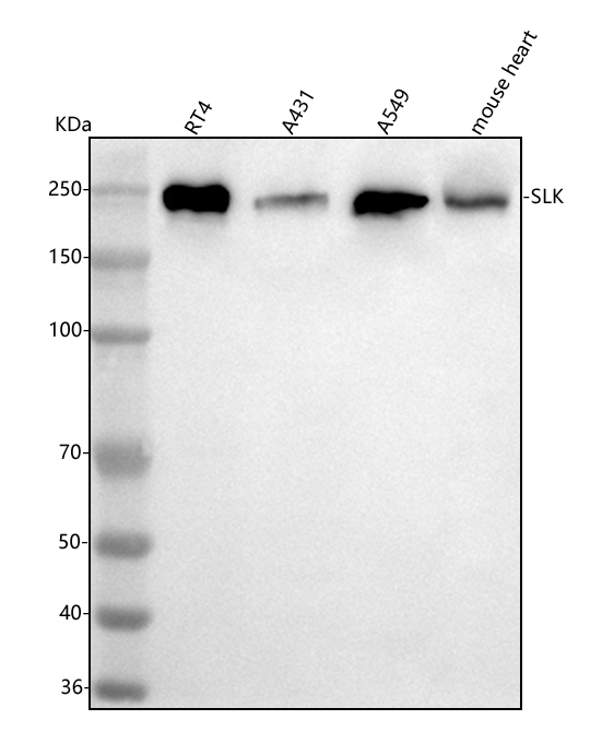  Western blot analysis of SLK using anti-SLK antibody (A01614-2)