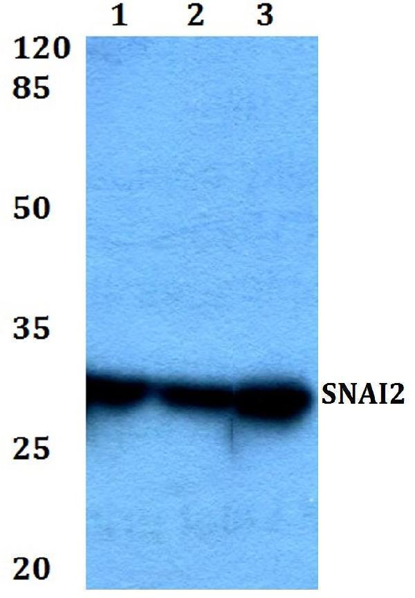 a01615 1 snai2 primary antiboties wb testing 1
