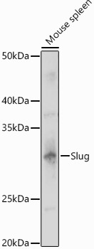 Western blot analysis of extracts of Mouse spleen, using Slug   antibody  at 1:1000 dilution